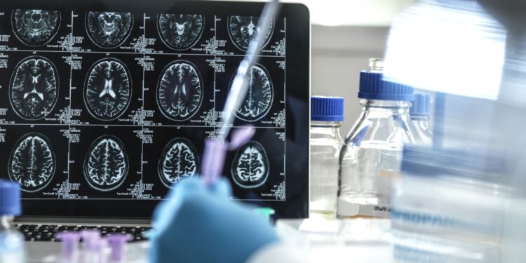 El fabricante del prometedor fármaco para el Alzheimer, Leqembi, espera la aprobación total de la FDA este verano y la ampliación de la cobertura de Medicare